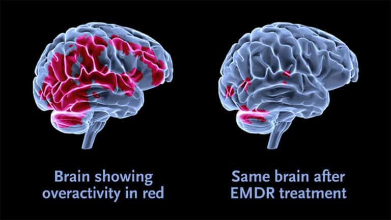 EMDR therapy Singapore